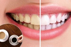 Will Iced Coffee Stain Teeth? Tips & Prevention Safem Fabrication - Precision Engineering & Custom Manufacturing Solutions Will Iced Coffee Stain Teeth? Tips & Prevention | Safem Fabrication - Precision Engineering & Custom Manufacturing Solutions