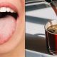 What is Coffee Tongue? Causes, Prevention & More! | The Ultimate Coffee Guide: Types, Brewing Methods & Best Beans