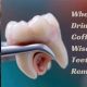 Wisdom Teeth: Iced Coffee After Removal - Is It Safe? | The Ultimate Coffee Guide: Types, Brewing Methods & Best Beans