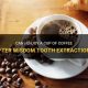 Coffee After Wisdom Teeth? Extraction Do's & Don'ts | The Ultimate Coffee Guide: Types, Brewing Methods & Best Beans