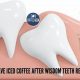 Iced Coffee After Wisdom Teeth Removal? Risks & Tips | The Ultimate Coffee Guide: Types, Brewing Methods & Best Beans