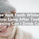After Whitening: How Long Until I Drink Coffee Safely? | The Ultimate Coffee Guide: Types, Brewing Methods & Best Beans